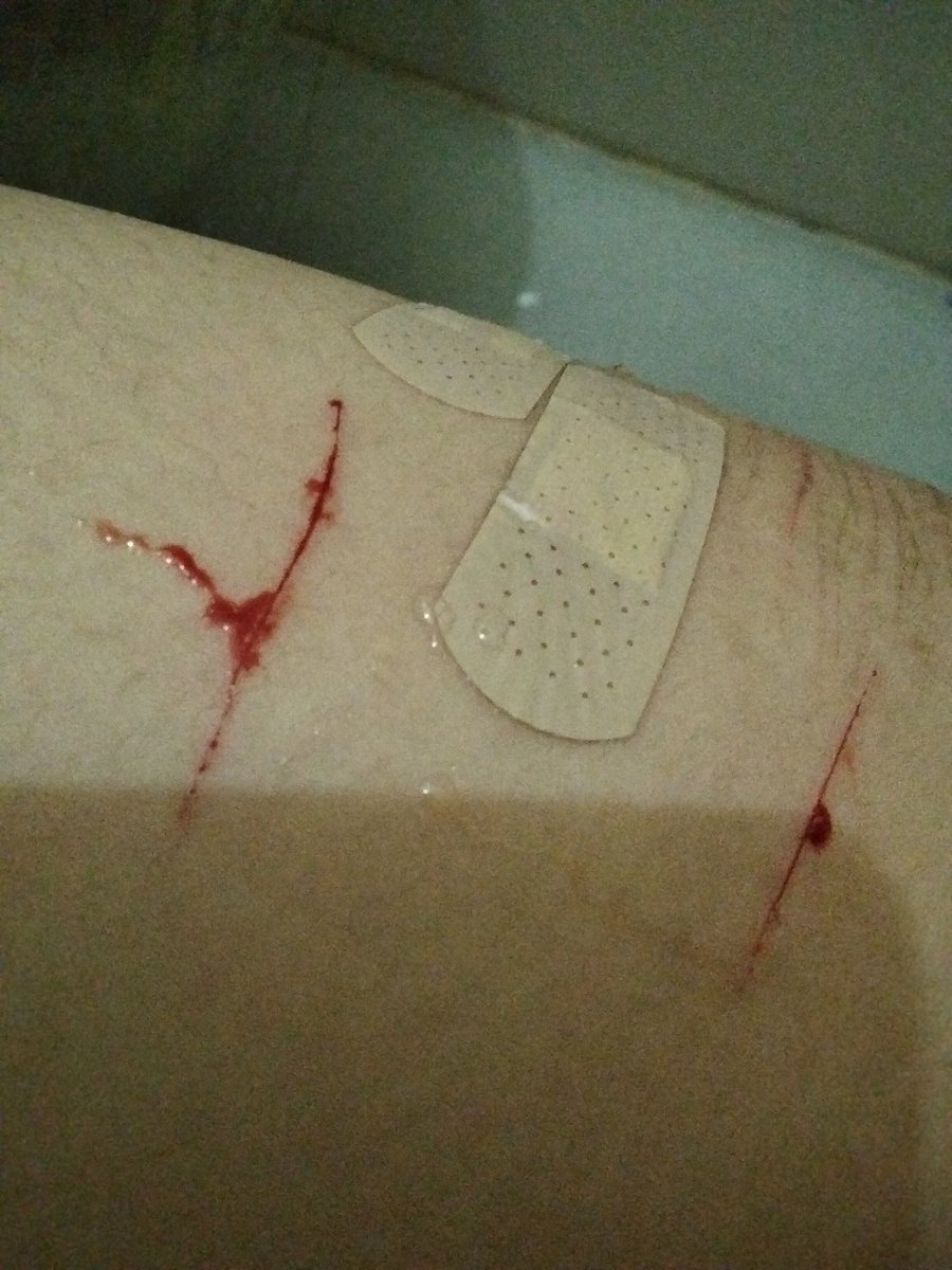 decl9ration's tweet photo. why cant I do more than 2 

FAKE SFX MAKEUP https://t.co/isMt5VFQYU
