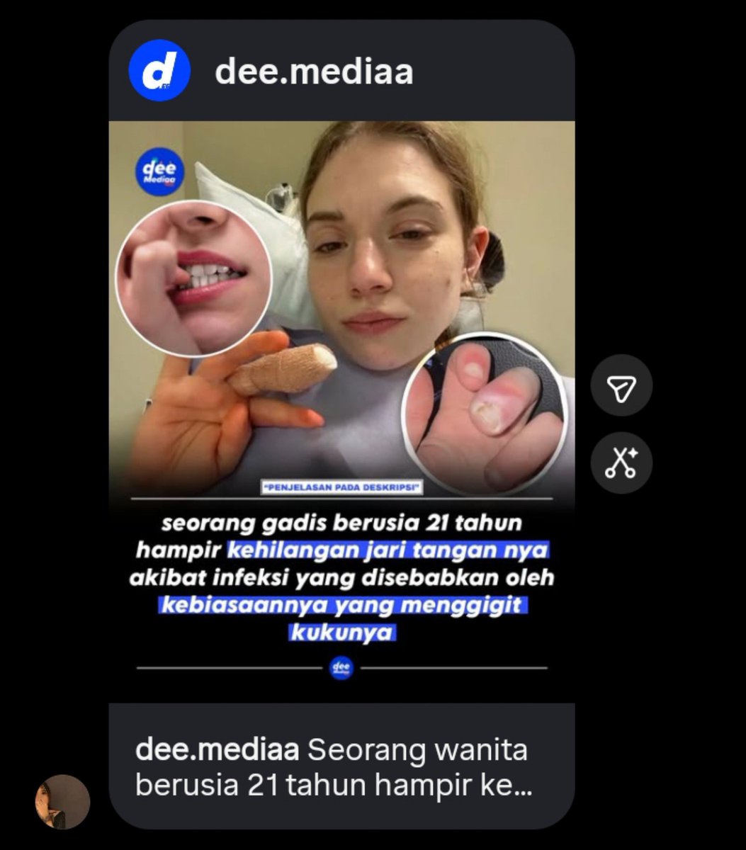 sdeofme's tweet photo. @milkytacandy dia ngasi tau udah dari setaun yg lalu kali guys, AND SHE KEEPS TELLING ME I'LL LOSE MY FINGERS https://t.co/3qjK6wRZx2