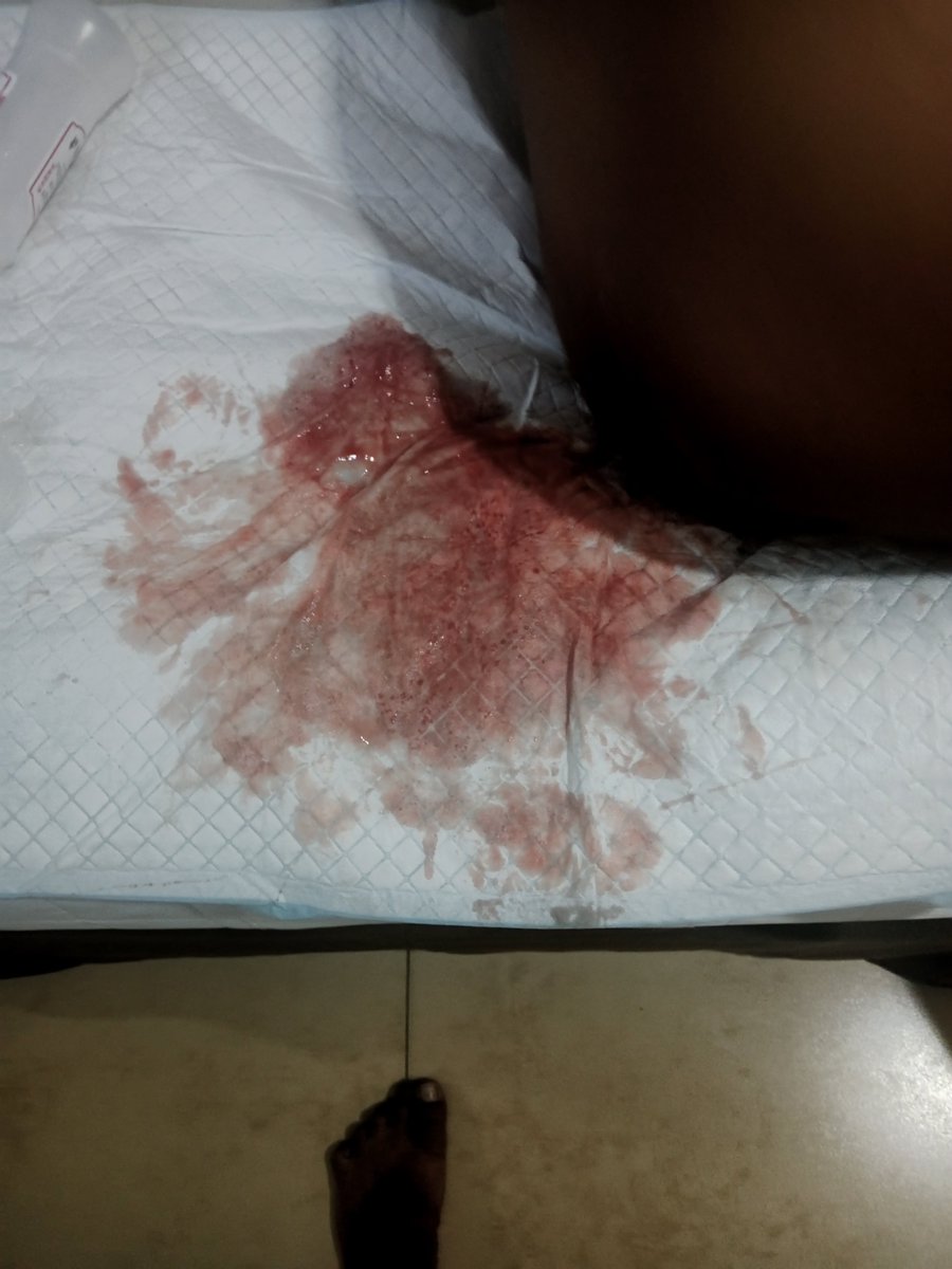 bataktobatop's tweet photo. Pertempuran lobang mungil mu dengan 🤛🤜✊🌹🌹
@gayasia
@gayindo
@gayjakarta
@bisex
@fisting
@fistee
@gaysingapore https://t.co/qxMODv0r0k