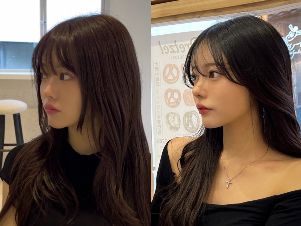 顎ヒアル溶かす
鼻フル2回
ダイエット
脂肪移植(額・頬)
ジュベルックボリューム(額・頬)

でこの違い🥲
並べてみたら結構違う^_^ https://t.co/V03Hg8wgft