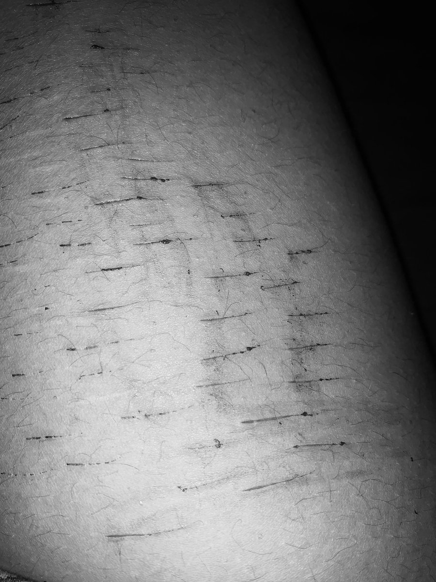 S0rrowZzz's tweet photo. Im not happy abt ts but yk…?

#shedtwt #shtwt #tagforfun https://t.co/Q0McQfvFn5