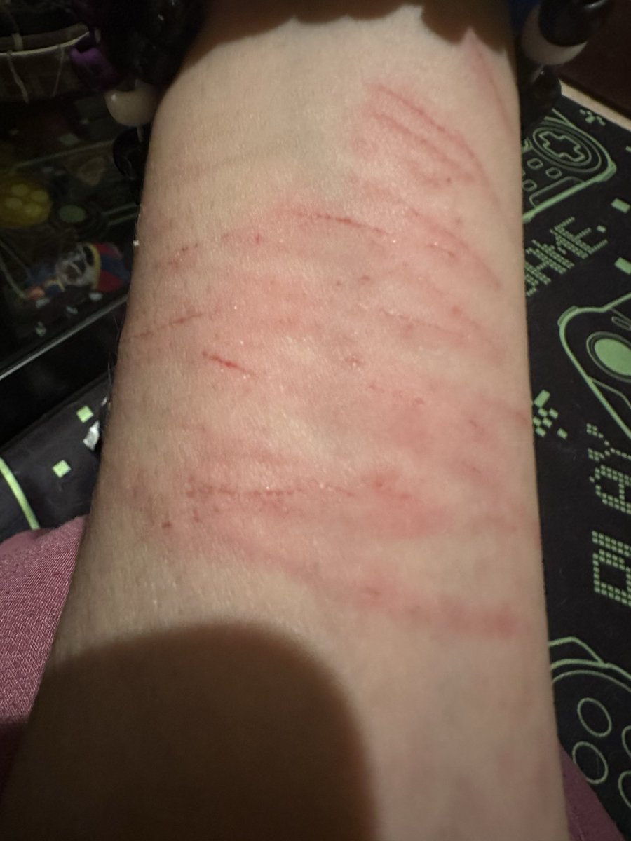 MNTALLYILLKID's tweet photo. Anger and being trapped in 
life creates tiger stripes did you know that? It’s true!
#shtwt #catscratches https://t.co/BJD8AQZz0x