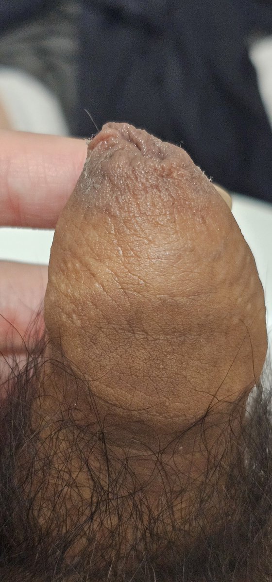 gay_SemenToilet's tweet photo. #ゲイ #gay #uncut #foreskin #チンカス #smegma #包皮垢 #sebo #cockcheese #ripedick #包茎 #dirtycock
🧀 https://t.co/ZgE6Lab7Tl