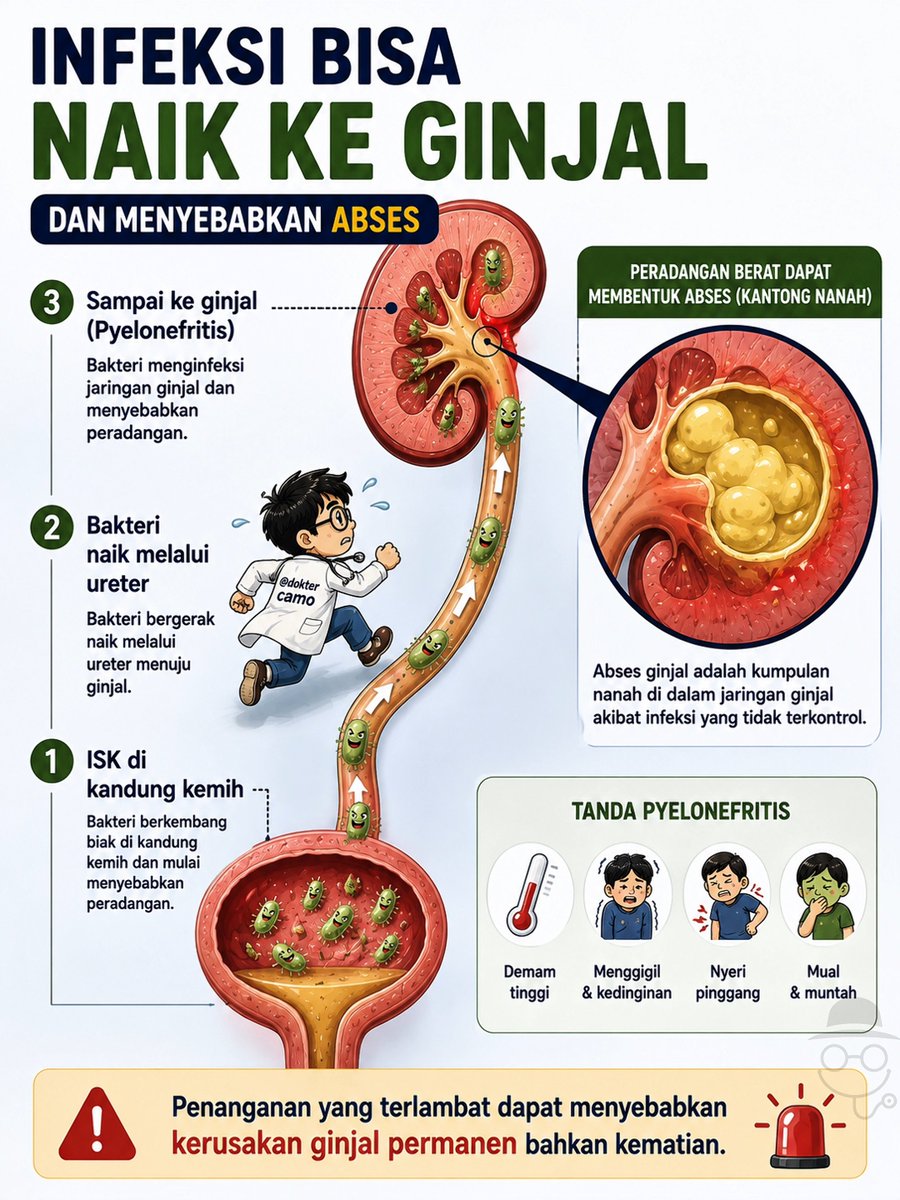 doktercamo's tweet photo. AWALNYA BESER/ANYANG-ANYANGEN, TERNYATA GINJAL BERNANAH ⁉️😰

Infeksi saluran kencing (ISK) bukan selalu berhenti di kandung kemih. Bila terlambat dikenali atau tidak tertangani dengan baik, bakteri bisa naik melalui ureter menuju ginjal, menyebabkan pielonefritis. Pada kondisi yang berat, infeksi bahkan dapat membentuk abses (kantong nanah) di ginjal.

Yang perlu diwaspadai antara lain: 
✅ Demam tinggi atau menggigil 
✅ Nyeri pinggang 
✅ Anyang-anyangan atau nyeri saat BAK
✅ Mual dan muntah

Bila infeksi terus menyebar hingga masuk ke aliran darah, kondisi ini disebut urosepsis. Ini adalah kegawatdaruratan medis yang dapat menyebabkan tekanan darah turun, gangguan fungsi organ, syok septik, bahkan mengancam nyawa.

🚨 Jangan menunda ke IGD bila mengalami: 
• Demam tinggi disertai menggigil 
• Nyeri pinggang hebat 
• Linglung atau penurunan kesadaran 
• Napas cepat atau sesak 
• Tekanan darah menurun atau tubuh terasa sangat lemas

Semakin cepat infeksi ditangani, semakin besar peluang untuk sembuh dan mencegah komplikasi yang lebih berat.
💬 Pernah mengalami infeksi saluran kencing? Bagikan pengalamanmu di kolom komentar.

#pyelonefritis #infeksisalurankemih #urinarytractinfection #infeksi #tanyadoktercamo