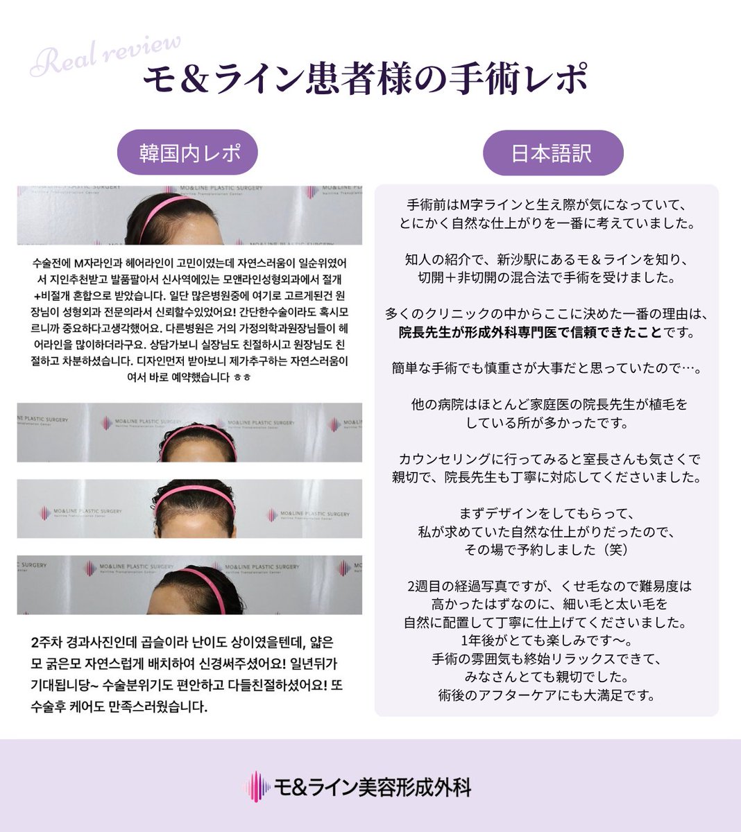 moandlineps_jp's tweet photo. モ＆ライン患者様の手術レポ💜 https://t.co/lVVSTeWK33