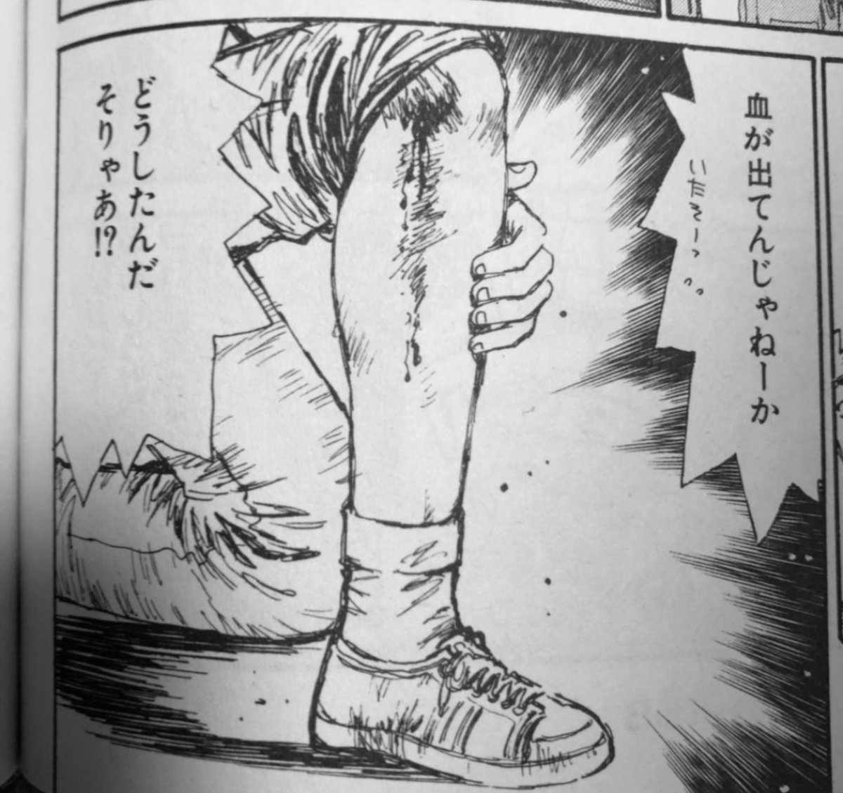 chiakichi223's tweet photo. 純正シートでジムカーナに参加すると膝が痛い😫
こうなる前にそろそろバケットを入れようかな。 https://t.co/sz2V6Ko3JC