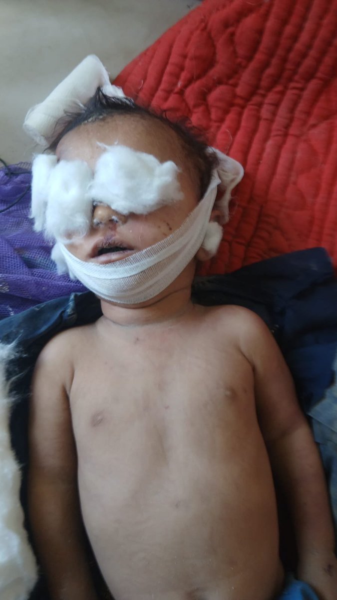 nobatmarri's tweet photo. Pakistan’s airstrikes on Surab, Balochistan, killing more than 20 people, including children, expose a fundamental imbalance of power: a heavily armed occupying state controls the skies of occupied Balochistan  while a defenceless civilian population has no means to protect itself from aerial bombardment.

This is precisely when the principle of civilian protection must mean something.

In 2011, the UN Security Council authorised a no-fly zone over Libya to protect civilians from attacks by the state.
If international protection is universal, it cannot be applied selectively.

Baloch civilians deserve protection from airstrikes. The international community must impose a no-fly zone over Balochistan.
#occupiedBalochistan
#humanrights