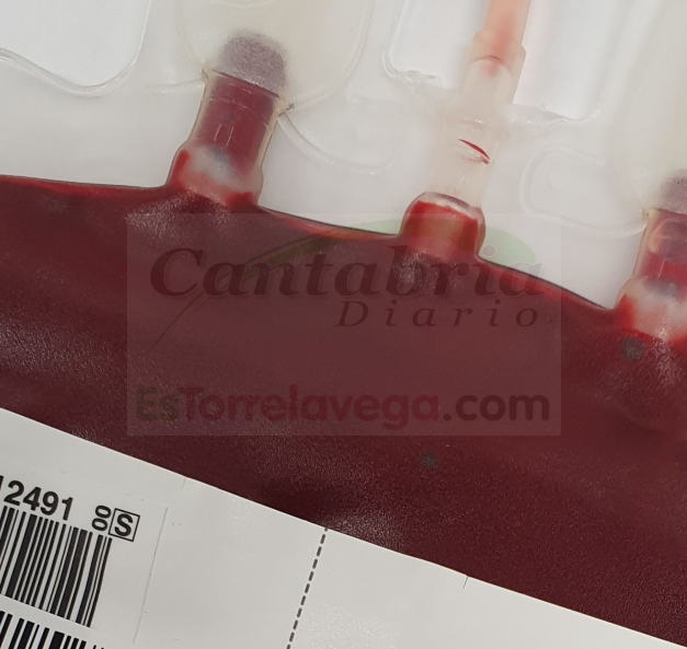 cantabriadiario's tweet photo. El Banco de Sangre de Cantabria necesita con urgencia donaciones de sangre del grupo 0-

https://t.co/Ve5o5e562U https://t.co/bFtbFSmt0q