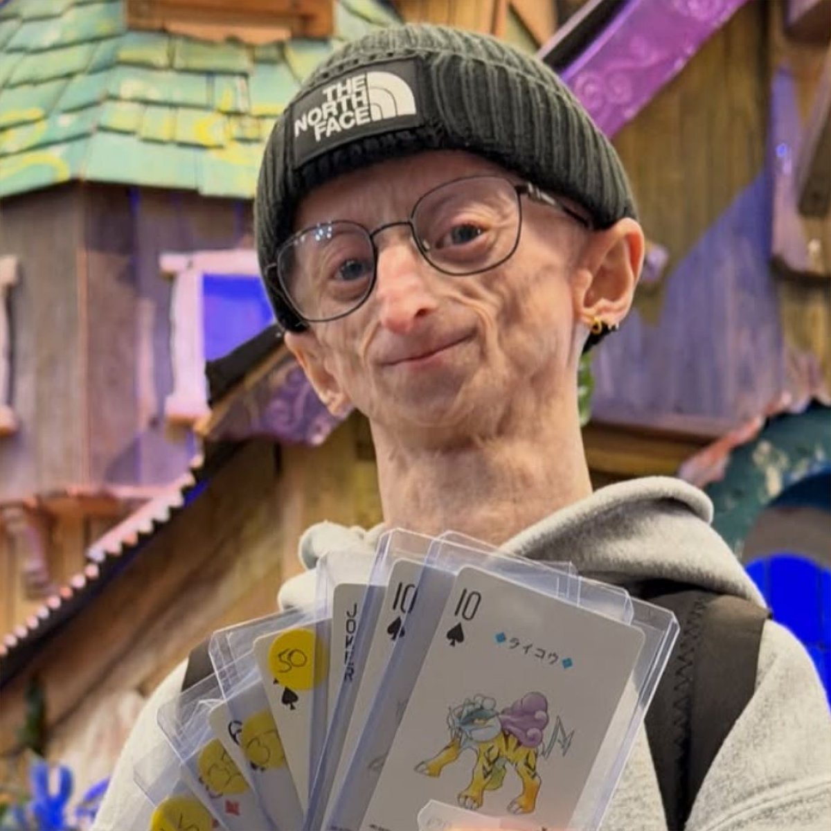 Dexerto's tweet photo. Influencer Michiel Vandeweert has died age 28 after documenting rare rapid aging disorder

He was twice the age doctors initially believed he would reach https://t.co/xXBhLTi4YY