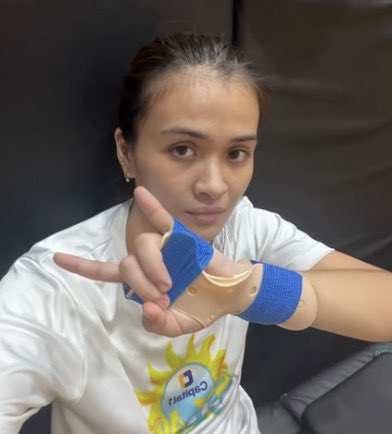 Madzilla1864's tweet photo. Sana talaga gumaling na yung wrist ni Bella almost 3 months na namamaga yung kamay niya. Pahinga ka maigi and pls recover soon. 🙏🏻🥹 #BellaBelen https://t.co/cz4EnWLep5