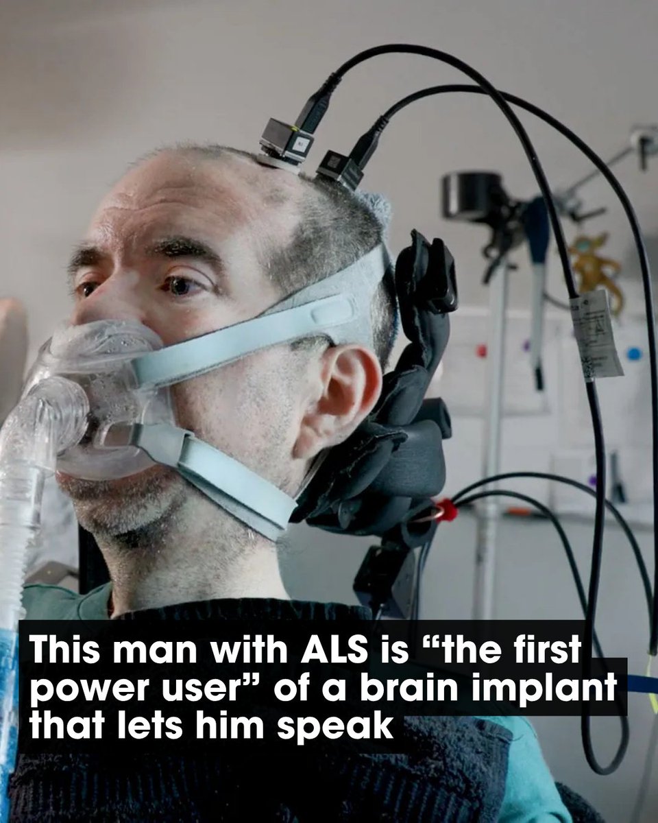 WevolverApp's tweet photo. Casey Harrell, a man with ALS, has become the first long-term “power user” of a brain-computer interface. After electrodes were implanted in his brain, the system decodes attempted speech into text and synthetic voice. With thousands of hours of independent use, Harrell now communicates with family, sends emails, browses the internet and works, demonstrating the potential of practical, everyday BCIs.

Credit: MIT

#engineering #technology