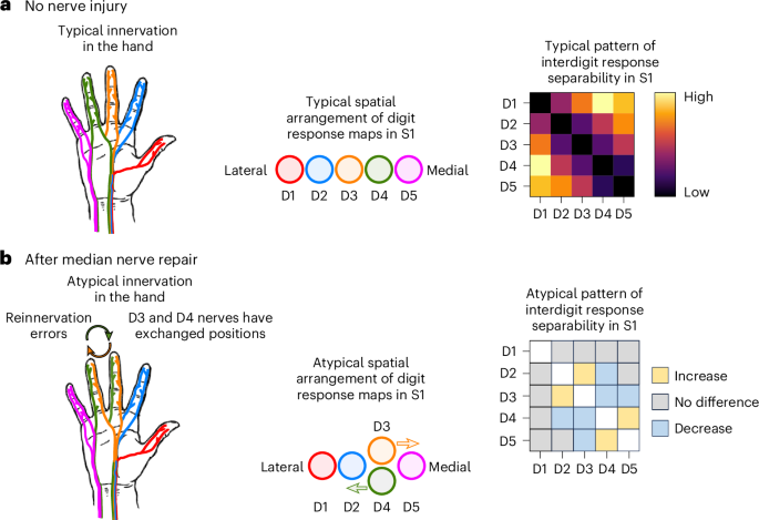 NatureHumBehav's tweet photo. Cutting a nerve of the hand alters the organization of digit maps in primary somatosensory cortex https://t.co/3lHfbHewha https://t.co/yCaxWMh7RM