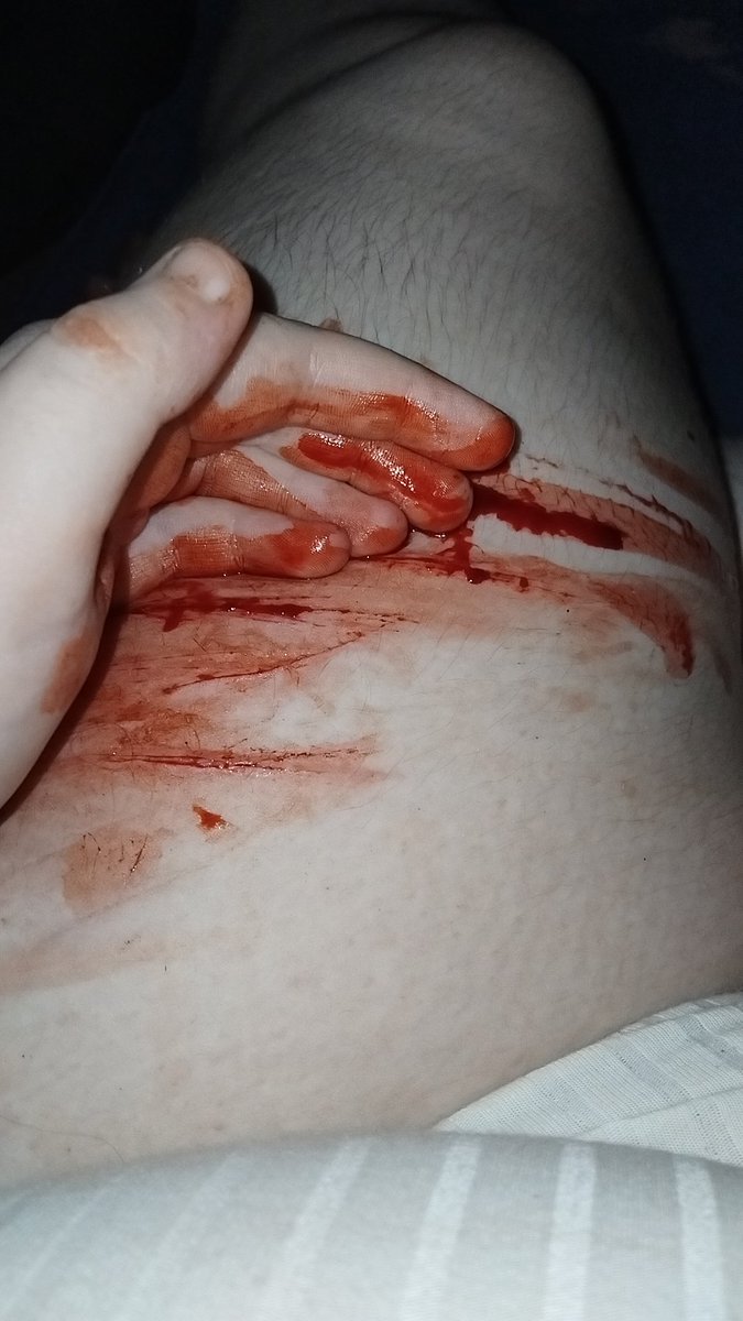 Shizukachap's tweet photo. Am i vaild as a sfx makeup artist yet #shedtwt #slittwt https://t.co/Fesgyz2E56