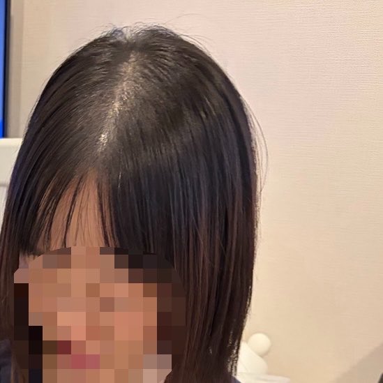 ppppp_8416's tweet photo. お久しぶりです💁🏻‍♀️産後間もなく1年ですが相変わらずハゲてる！！！一応ヘアシャドウしてます！！！前髪も生え揃ってきたのに縮毛矯正したばかりだからか尚更ボリュームダウンして見える、他撮りキツすぎぃぃ〜 https://t.co/e5SMEuLSY5