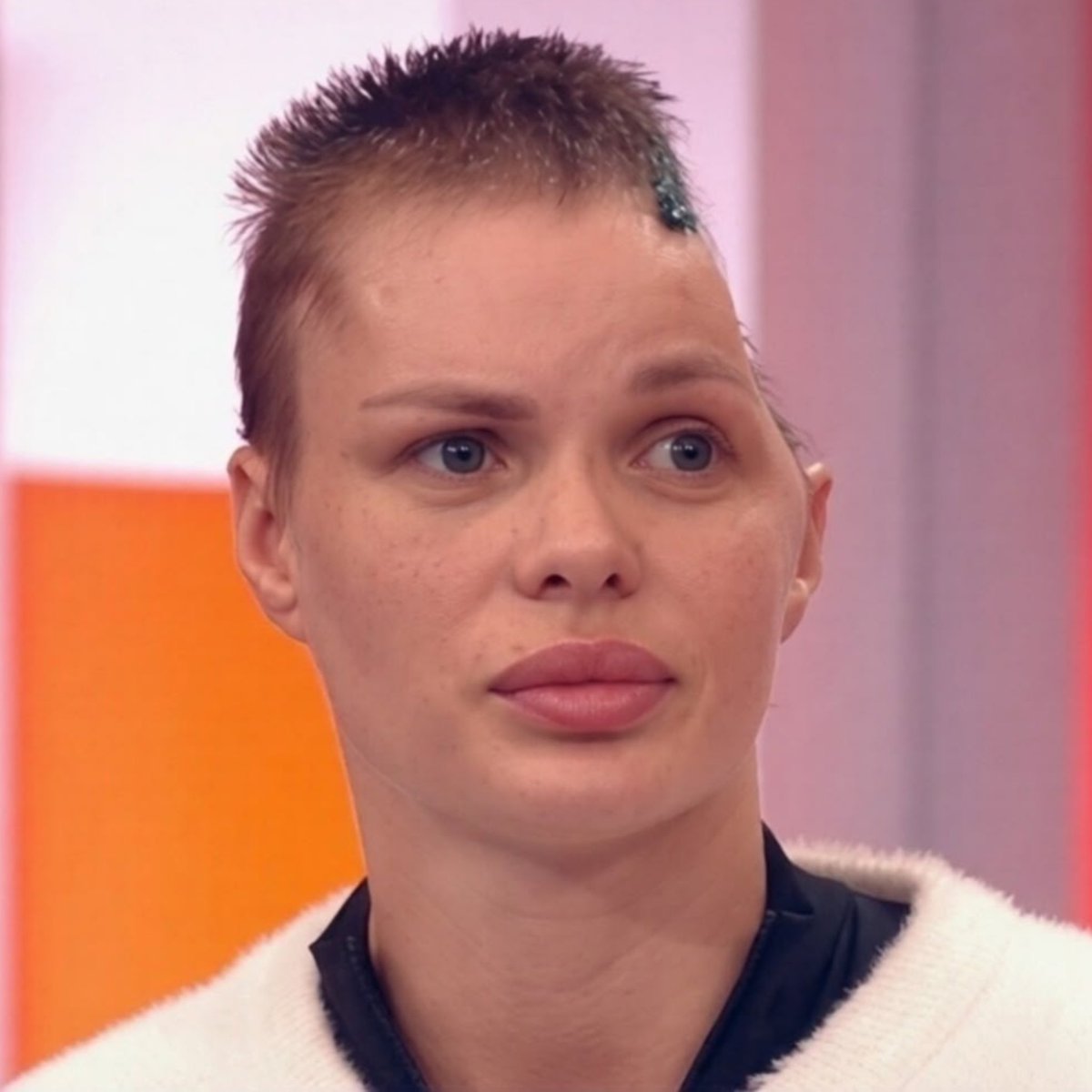 creepydotorg's tweet photo. Angelika Tartanova, a 33-year-old Russian model, lost nearly half her skull after being severely beaten by her boyfriend, wealthy construction businessman Dmitry Kuzmin.

The attack left her with severe brain damage. She was unable to speak for months and required several operations and extensive rehabilitation.

Kuzmin was later charged with attempted murder and faced up to eight years in a Russian prison or being sent to fight in Ukraine.

But before he could stand trial, he suddenly died of a heart attack while under house arrest. Angelika survived and continues to recover.