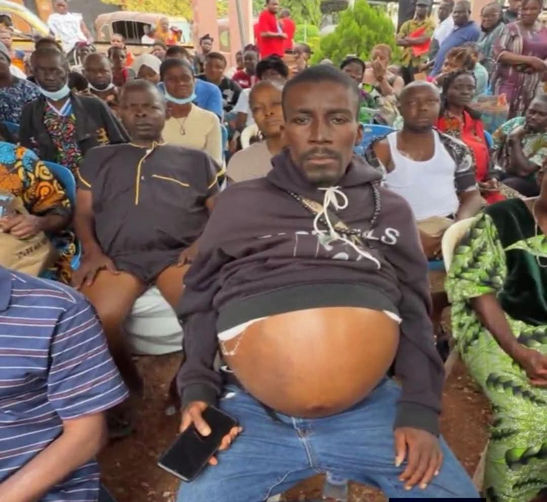 Kene_Nnewi's tweet photo. OVER 500 KIDNEY PATIENTS CRY FOR HELP AT ENUGU GATHERING AS FAMILIES BATTLE FOR SURVIVAL

It was a deeply disturbing and emotional sight on Thursday, August 13, 2026, as more than 500 people living with kidney-related illnesses converged at Parklane in Enugu, answering a call by Okwuluora in the hope of receiving desperately needed assistance.

Men, women, and children filled the venue, many of them carrying the visible signs of prolonged illness and hardship. Some patients are reportedly due for dialysis but cannot afford the treatment, leaving them and their families trapped in a painful battle for survival.

For some, the struggle was written plainly on their bodies—bloated bellies, swollen hands, arms, and legs, and faces marked by uncertainty as they waited for the arrival of an unnamed philanthropist who was expected to offer assistance to those he could reach.

Among those at the gathering was a 13-year-old boy from Akure, Ondo State, whose mother has reportedly sold everything she owns to keep up with his dialysis treatment for the past five years.

After years of sacrifice, the young boy was still at Parklane, waiting and hoping that he would be among those whose lives could be changed by the expected intervention.

The sheer number of patients at the venue has raised fresh and troubling questions about the scale of kidney disease and the burden of dialysis and transplant care in the region.