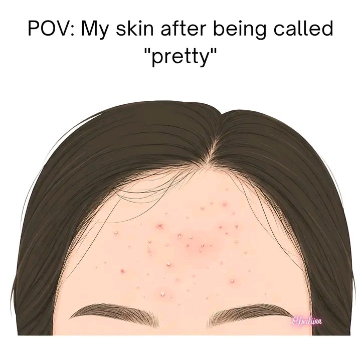 Afs_Afsu's tweet photo. nazar is so real 😭

me after 1 compliment: 
"you're pretty"
my skin: 👀

anyone else or just me? 
#nazar #relatable https://t.co/ho4iWQEYGQ
