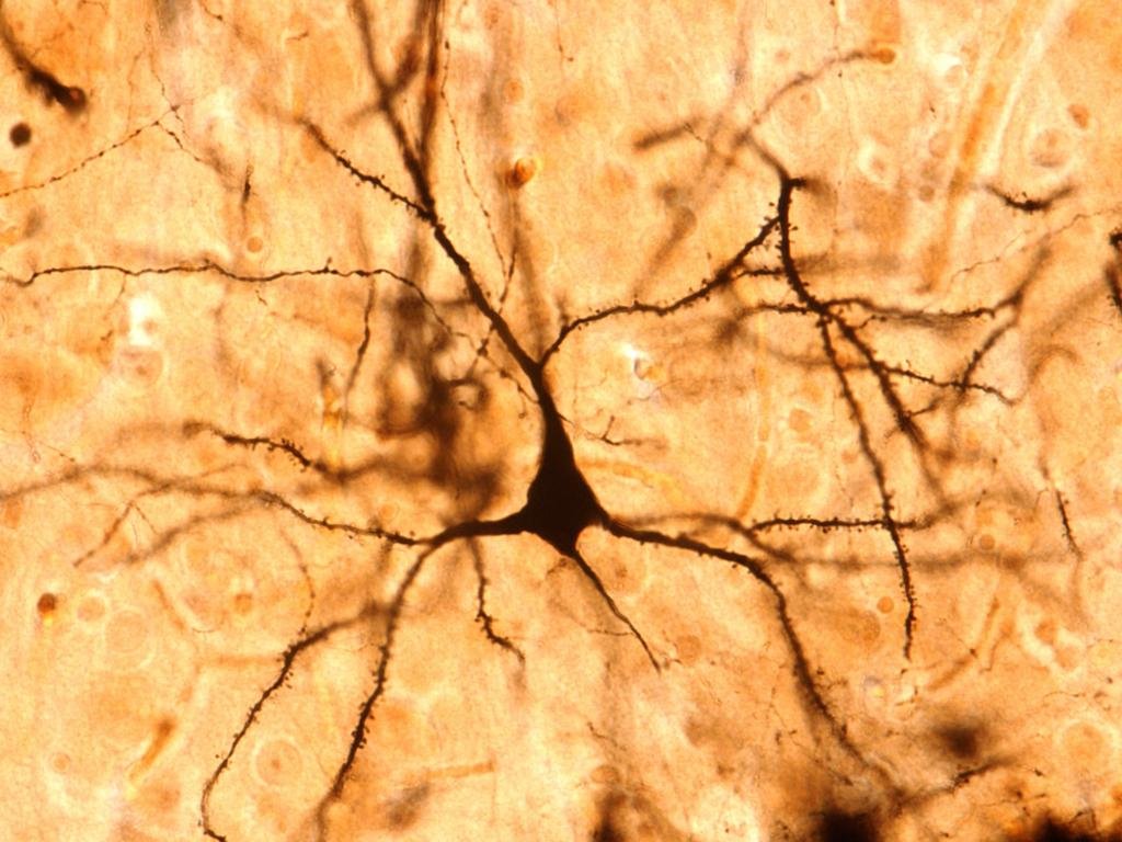 DiscoverHQ's tweet photo. 🧠 خلية واحدة في دماغك أعقد مما كنا نعتقد!

كشفت دراسة جديدة في 2026 أن الخلية العصب��ة البشرية الواحدة قادرة على تنفيذ عمليات حسابية معقدة، و��أنها حاسوب بيولوجي صغير

اكتشاف قد يساعدنا على فهم سر القدرات الاستثنائية للدماغ البشري. https://t.co/eJR504Q4Aa