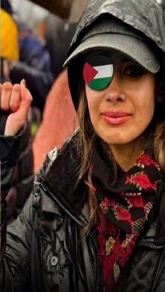 Abdullah_Om3r03's tweet photo. Her eye was gone, but she refused to surrender. An Australian woman lost her eye while standing for Palestine, but returned wearing an eye patch bearing the Palestinian flag.

In a courageous act that embodies the meaning of resilience, Australian activist Hannah Thomas gained widespread attention on social media for her prominent participation in the movement supporting the Palestinian cause.

Hannah reportedly lost one of her eyes after being brutally assaulted by police while they were dispersing a peaceful protest in Australia in support of Palestinian rights.

Despite the severity of her injury and the health challenges she faced, Hannah refused to retreat or remain silent. She returned to participate in a major demonstration, wearing an eye patch decorated with the Palestinian flag.

Her stance sparked a wave of solidarity and praise around the world, with many people viewing her as a powerful example of the free people of the world, whose courage shines brightest in difficult times.

Hannah continues to raise her voice, emphasizing that physical disability will not stop her from standing up for just humanitarian causes.