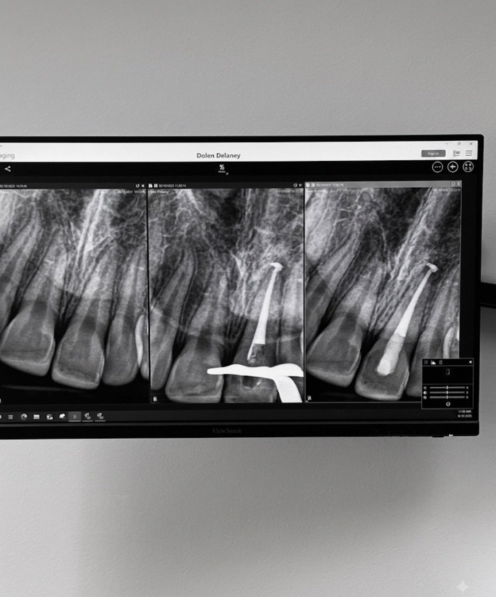 scottdatropa's tweet photo. Salvando mais um dente, amo fazer canal.🦷 https://t.co/U9P9JjVaUS