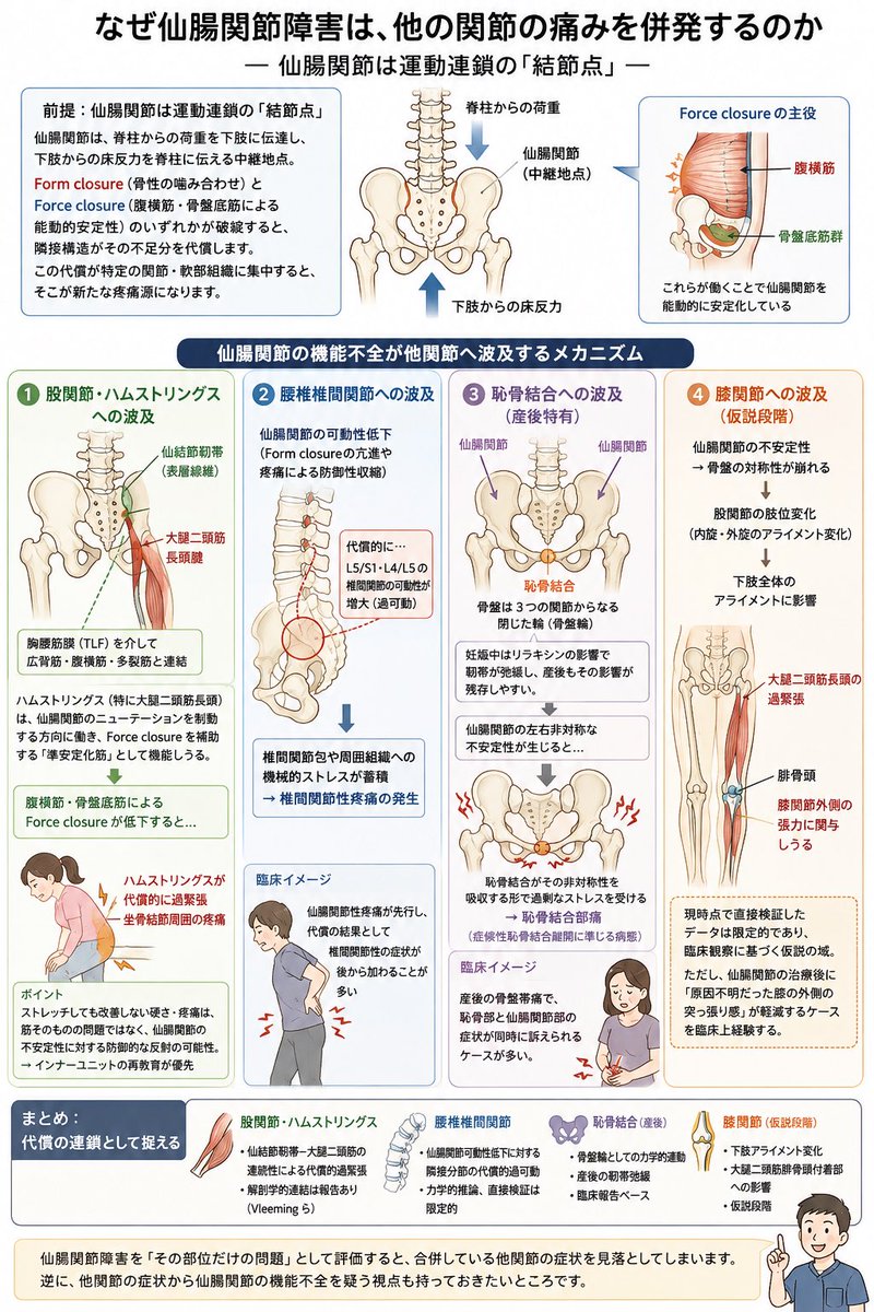 taro12taro6's tweet photo. 腰(仙腸関節)を治療しているのに、いつの間にか股関節や膝まで痛いと言われる。

これ、偶然じゃありません。

仙腸���節は運動連鎖の「結節点」。機能不全が起きると、代償は隣接する関節に必ず現れます。

noteでまとめて紹介しています。

https://t.co/419TQk6Ptr https://t.co/1juHElCi0c