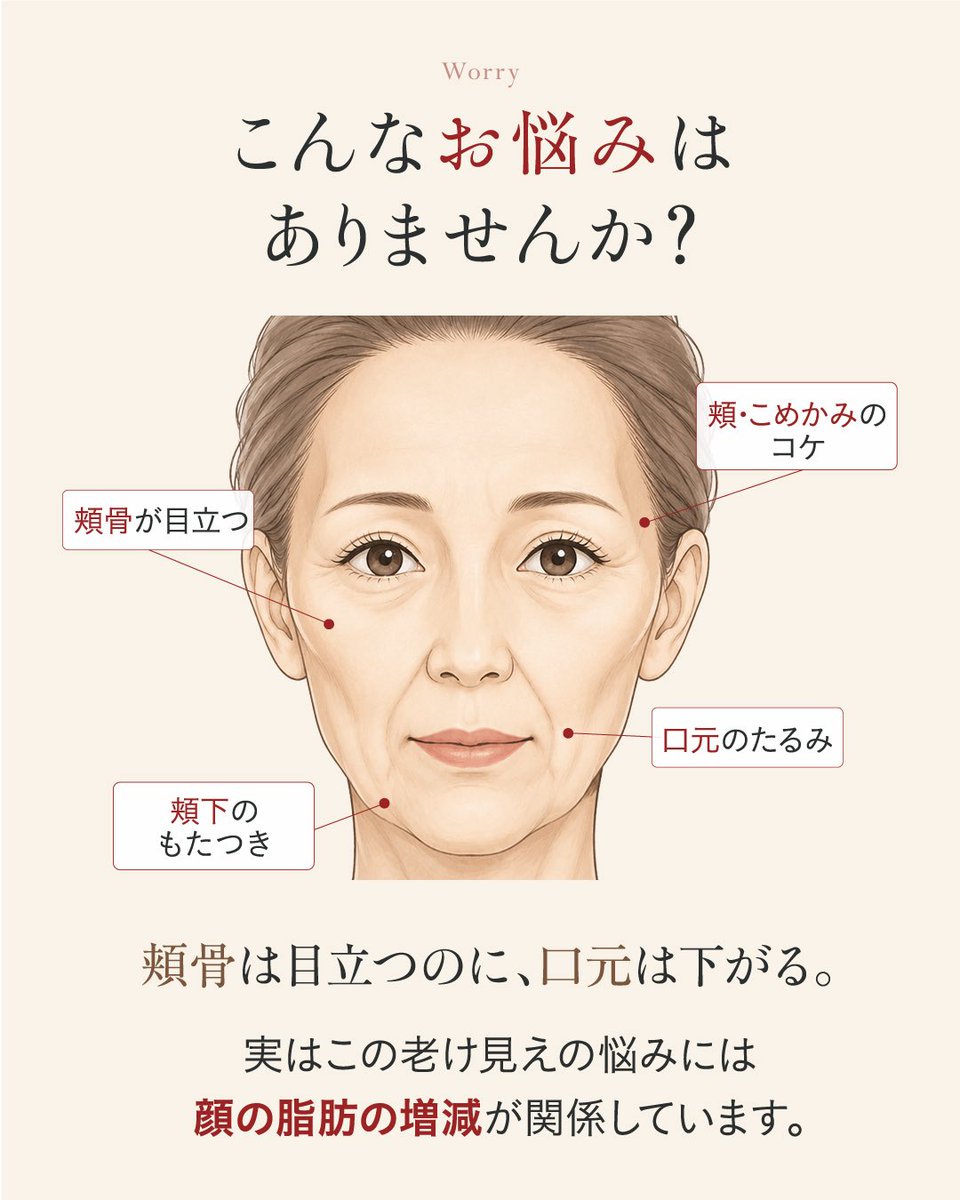 yuukitheclinic's tweet photo. 【顔の脂肪吸引＋脂肪注入｜施術モニター募集】

35歳以上の女性を対象に、
顔の脂肪吸引＋脂肪注入の施術モニターを募集します。

【募集内容】
・顔出しモニター：1名様／施術費無料
・顔出しなしモニター：50％OFF

【応募条件】
・施術前後の撮影にご協力いただける方
・THE CLINIC 東京院で施術を受けていただける方
・35歳以上の女性の方

【応募方法】
① 当アカウントをフォロー＆この投稿にいいね＆リポスト
② DMに自動で届く応募用リンクから必要事項を送信
選考後、対象となった方へ当クリニックよりご連絡いたします。

皆さまのご応募お待ちしております！