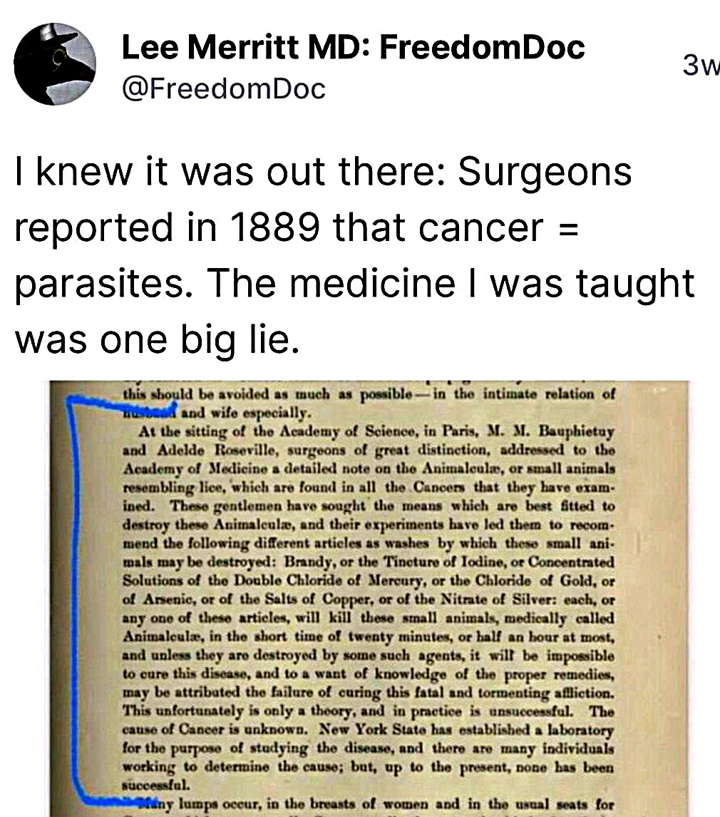 iontecs_pemf's tweet photo. All c@ncers are 100% of the time parasites. Ardis is couching his statement but knows this is true because the medical mafia is a multi-trillion dollar hit squad. Make no mistake, every form of c@ncer I've ever research (a LOT) has always been parasites.