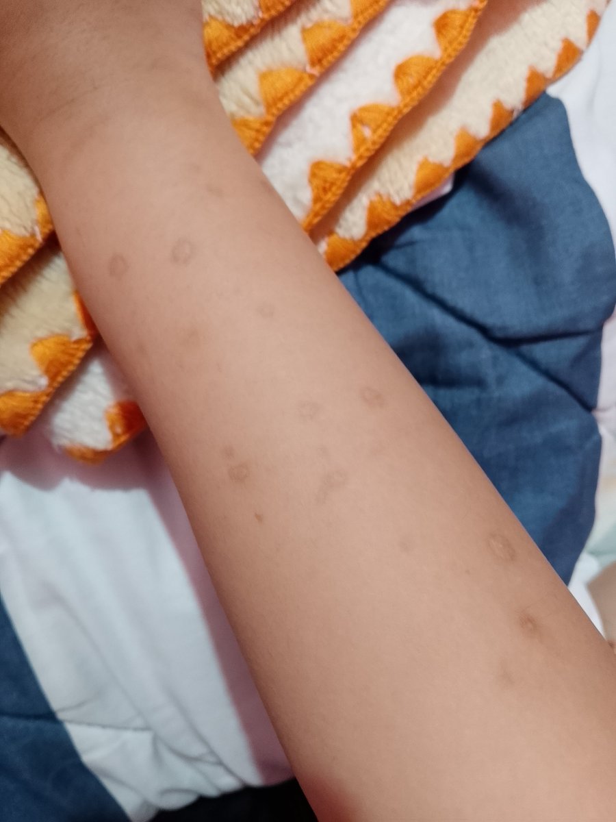 iwant2feel4ever's tweet photo. ALL FAKE!!! MAKEUP SFX
plspls be completely honest idc would u consider my s h to be severe?? like what level of it would u consider it to be???? BE RLLY HONEST!!! https://t.co/bYxVLcoTu5