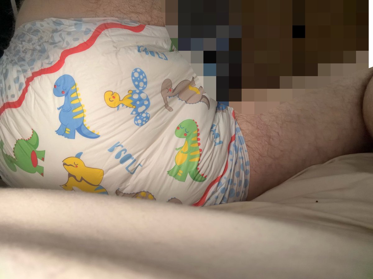 HarryGaming7's tweet photo. First Time wearing a stent and it was amazing. 
It worked perfectly. https://t.co/STxERX6y4Z