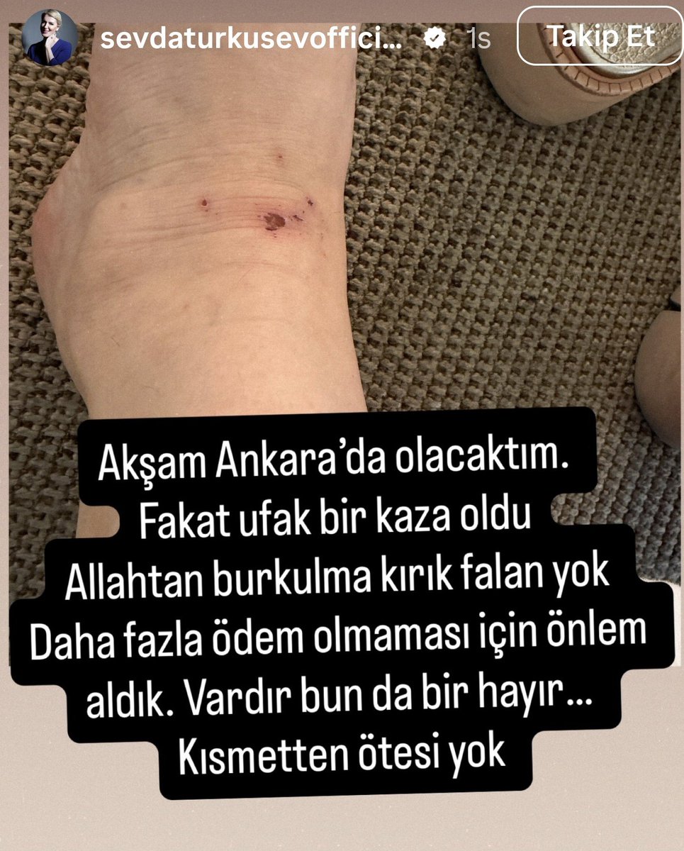TekyHan's tweet photo. @iremderici Sevda instagram hikayesinde sana hitaben bir konuşma yaptı ve sonrası⤵️⤵️ https://t.co/cTOZXEGEOt