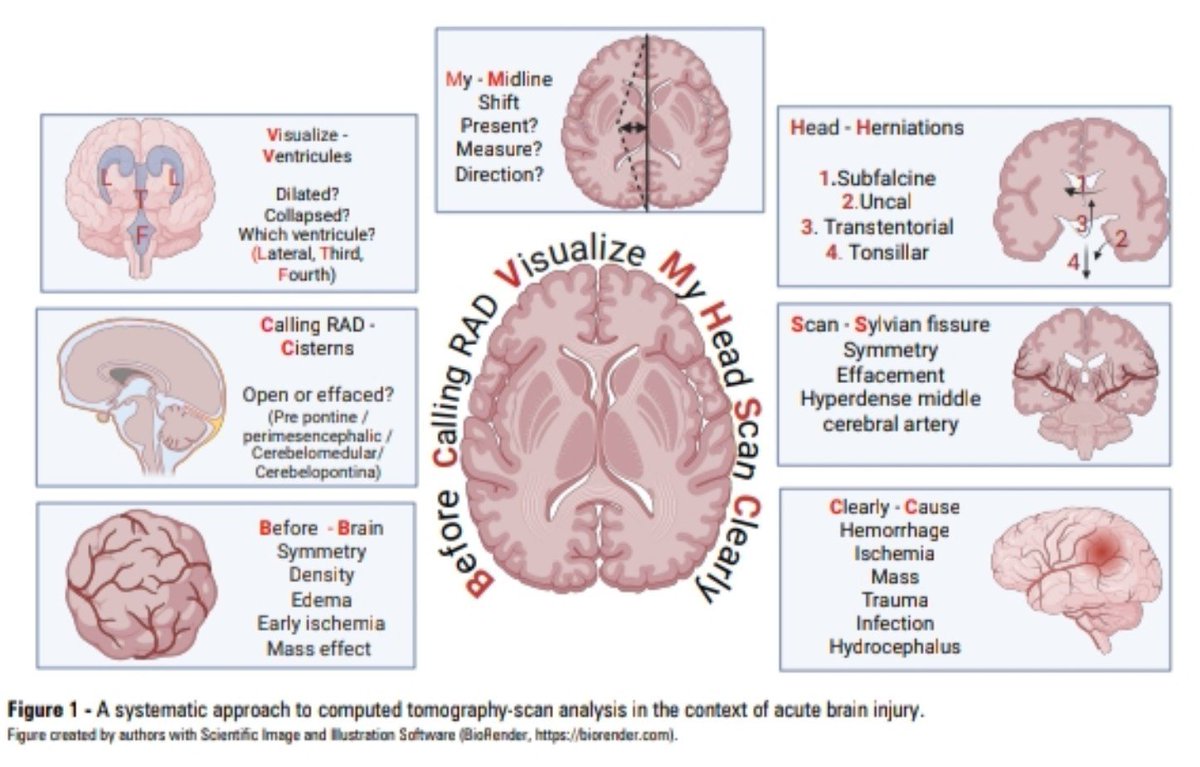 Leo_Santo5's tweet photo. 🧠 ¿Ves una TAC de cráneo… O Realmente Sabes Qué Buscar? 

🤔 Parénquima Cerebral
⭕Cisternas
👁️Ventrículos
↔️Línea media
🚨Herniaciones

📖 Critical Care Science

Artículo Completo👇🏻✅🆓
https://t.co/aR5SFK2xfj https://t.co/LX0DmgXCVB