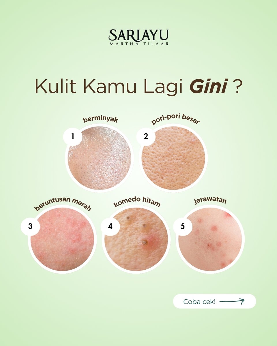 Sariayu_MT's tweet photo. Coba kamu cek kondisi kulit kamu kaya gimana, Sahabat Sariayu? Kalau ada kaya salah satu dari di atas, kamu bisa cobain pakai rangkaian Sariayu Acne Care Series ya!

#Sariayu #SariayuAcneCare #SariayuAcne #AcneFighter #CleanBeauty https://t.co/z1P9u6qxtv