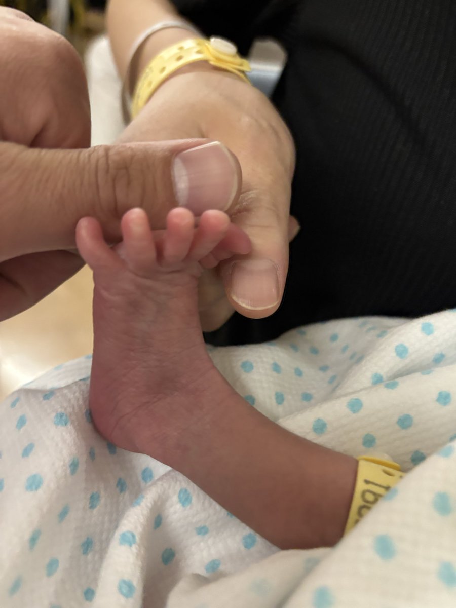 ioaoi87chaewon's tweet photo. 先日、双子、無事出産しました〜👶🏻👶🏻
（もう退院もしてます😌）
男女の双子です🩷🩵
お姉ちゃんと弟くんです🫶🏻
妊娠中、励ましてくれたり応援してくれたりあたたかいお言葉をくれたピオナのみなさん、本当にありがとうございました😭
双子育児、楽しみながらがんばります💪🏻 https://t.co/VYUT6GsgvH
