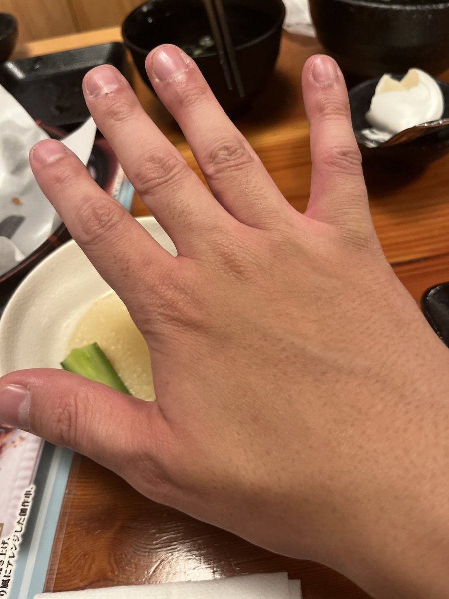 mantatun's tweet photo. マンタさんは酒を入れると手のひらが真っ赤になる https://t.co/2ZWwbDjWAP