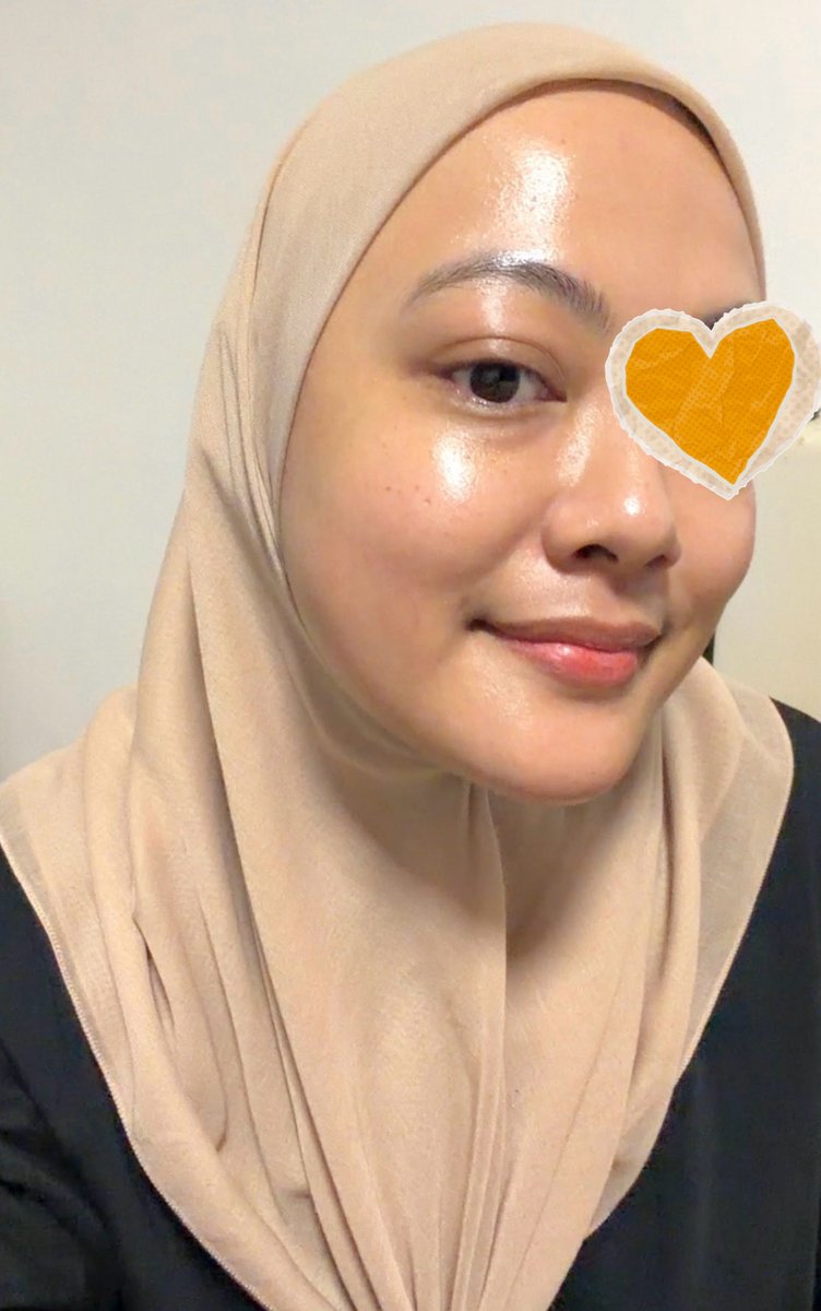 cikinsopee's tweet photo. Okay dah faham hype kenapa orang FOMO sangat toner hada labo ni. Within 2 weeks, pun dah boleh dapat KULIT TELUR REBUS ✨ https://t.co/Q7mvR5CUpz
