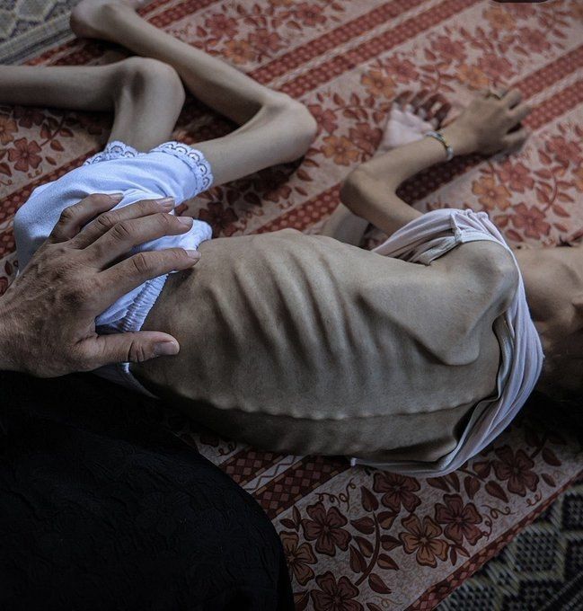 MyPalestine0's tweet photo. نحن أهلكم في غزة، فلا تتركونا وحدنا .

الجوع في غزة ليس خبرًا ... بل واقعًا يوميًا .

لم يبقَ إلا العظم والصبر . https://t.co/oRjpLIKIYM