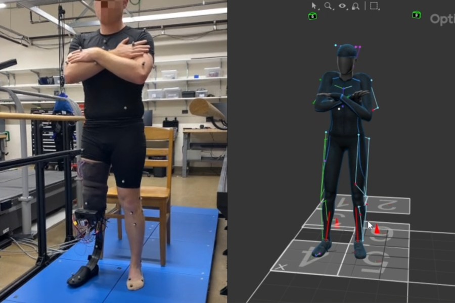 PurdueEngineers's tweet photo. Globally, more than 50 million people are living with limb amputation. But current in-socket sensing systems remain largely limited. 

@PurdueBME, @PurdueME and @NDengineering have developed a wearable solution. Read more about the innovation, featured today in Science Advances: https://t.co/npnvnh8ZZ4