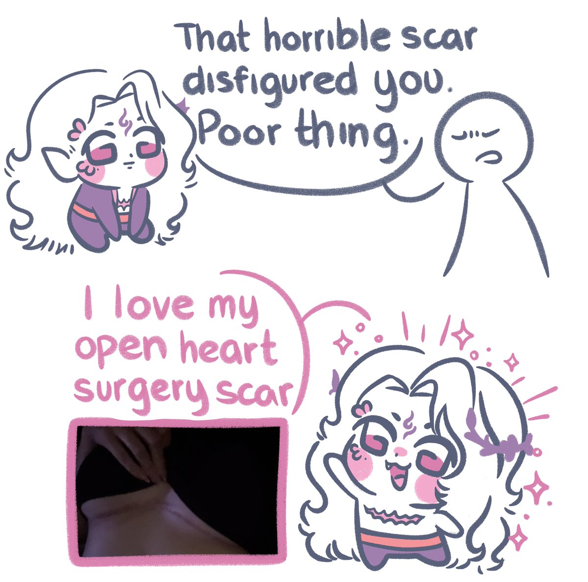 Abortius's tweet photo. This scar added character 🪷
Loved it sm that I added it to my VTuber ✨

Hole in my Heart 💘
(Ventricular Septal Defect) https://t.co/3eXiAbx7eL