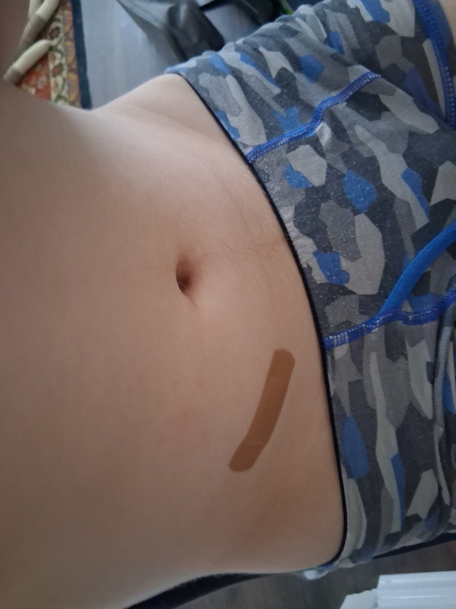 lauduline's tweet photo. 8th injection:

i pricked my tummy with the needle a bit and some of my estrodial leaked out but it's better than depression-slopping and doing nothing https://t.co/3vvjCJZMGe