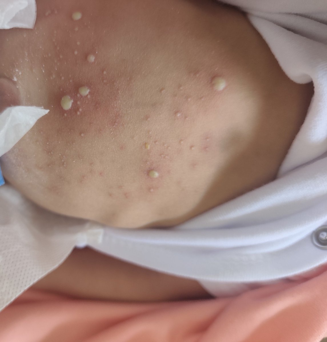 rola_almoghrabi's tweet photo. MY CHILD IS DYING, PLEASE😭 

︎
︎

︎

︎

︎
︎
︎

︎

︎

︎

︎don’t forget me🥺
︎

︎

︎

︎

︎

︎
︎

︎
please care

︎
︎

︎
︎

︎
︎

︎

︎

︎

︎
︎

︎

Scabies has spread all over my child's body I am worried about my baby girl 😥😭
https://t.co/FLk3iM7URh https://t.co/tHhcHcIoE6