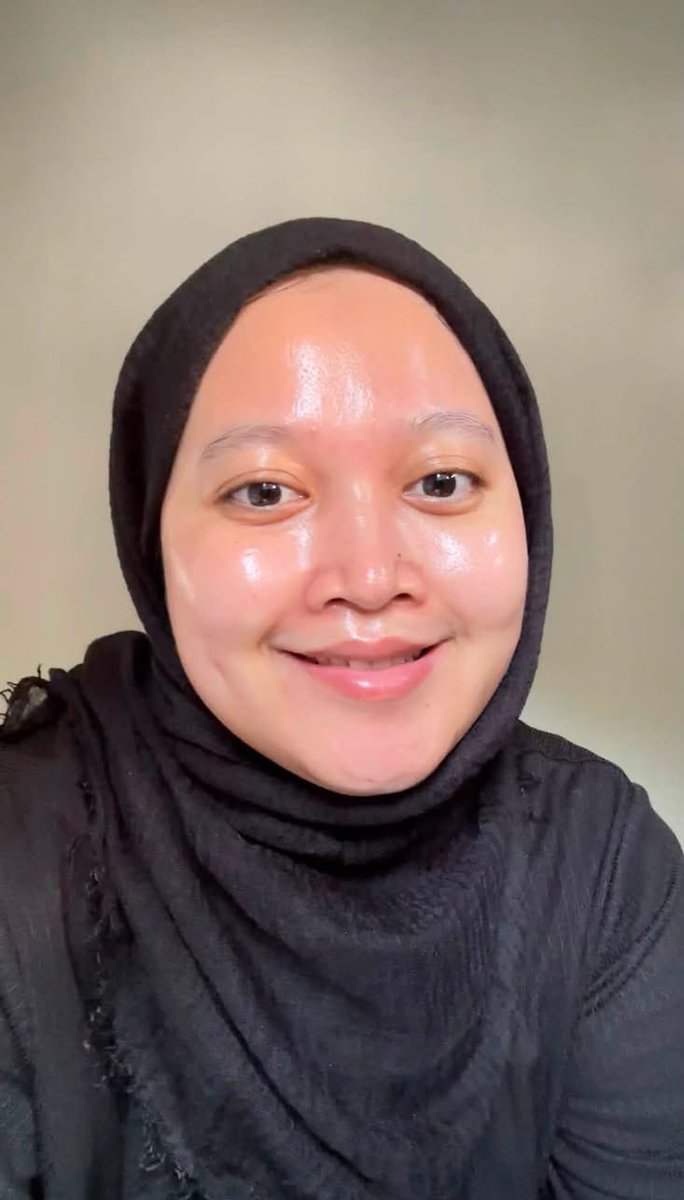nrlhudaadam's tweet photo. BEFORE VS AFTER😭

i dah jumpa skincare yang buat muka i macam lampu stadium. sekarang masalah i cuma nak jawab orang asyik tanya pakai apa?😂✨ https://t.co/ZT78Wc7Ntk
