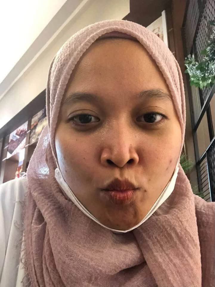 nrlhudaadam's tweet photo. BEFORE VS AFTER😭

i dah jumpa skincare yang buat muka i macam lampu stadium. sekarang masalah i cuma nak jawab orang asyik tanya pakai apa?😂✨ https://t.co/ZT78Wc7Ntk