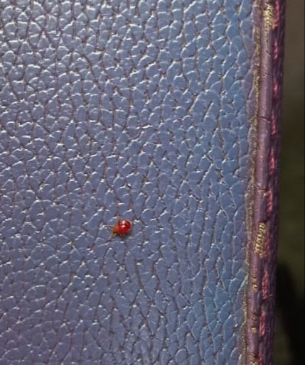 hariskaranam's tweet photo. @RailMinIndia @AshwiniVaishnaw @RailwaySeva  My wife travelled by Garibrath  (12740: SC to VSKP) , (G10-60-LB) on 09th Aug.  She had a horrible experience with bed bugs in the berth. She got allergy on her face , hands, body, legs and is swollen.  Pls take necessary action. https://t.co/8jvjfwMMr0
