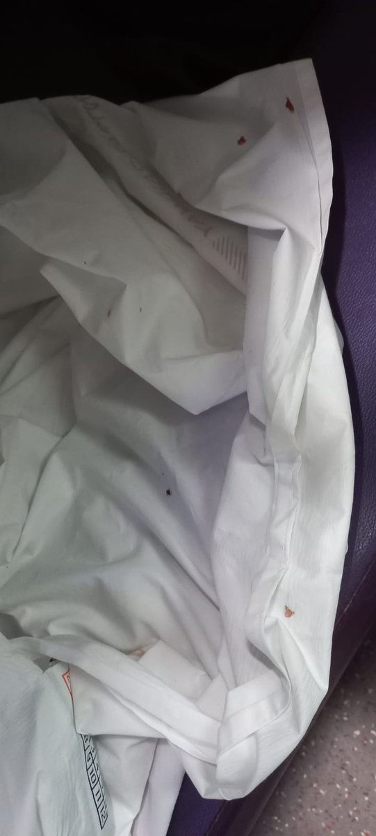 hariskaranam's tweet photo. @RailMinIndia @AshwiniVaishnaw @RailwaySeva  My wife travelled by Garibrath  (12740: SC to VSKP) , (G10-60-LB) on 09th Aug.  She had a horrible experience with bed bugs in the berth. She got allergy on her face , hands, body, legs and is swollen.  Pls take necessary action. https://t.co/8jvjfwMMr0