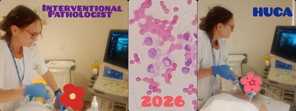 duckhuca's tweet photo. 💉 Another Pathologist is completing her training in Interventional Pathology within the Pathology Department at @HUCA_Asturias.
👏🏽 It has been a pleasure to share our experience (US FNA and US CNB) with Dr Tamara @LangerPath from Hospital Universitario San Pedro @riojasalud. https://t.co/c6JnIO6Bh1