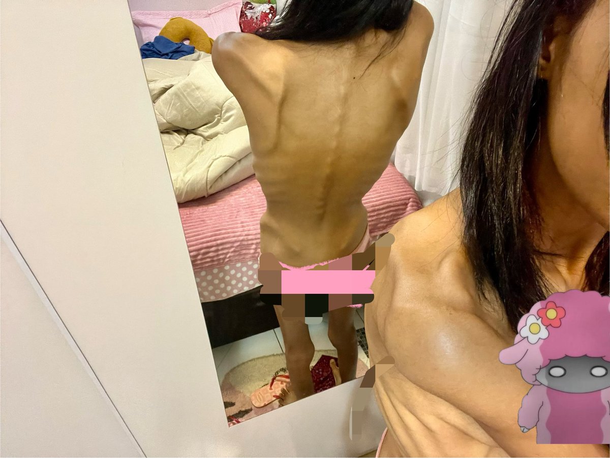 snoopyrexiic's tweet photo. i feel like im rotting away, i just feel sleepy all day, my legs hurts so bad, ive struggling a lot with my steps cause legs pain, but im not even that skinny like i should be to feel all that https://t.co/JFDFV8wJ6a