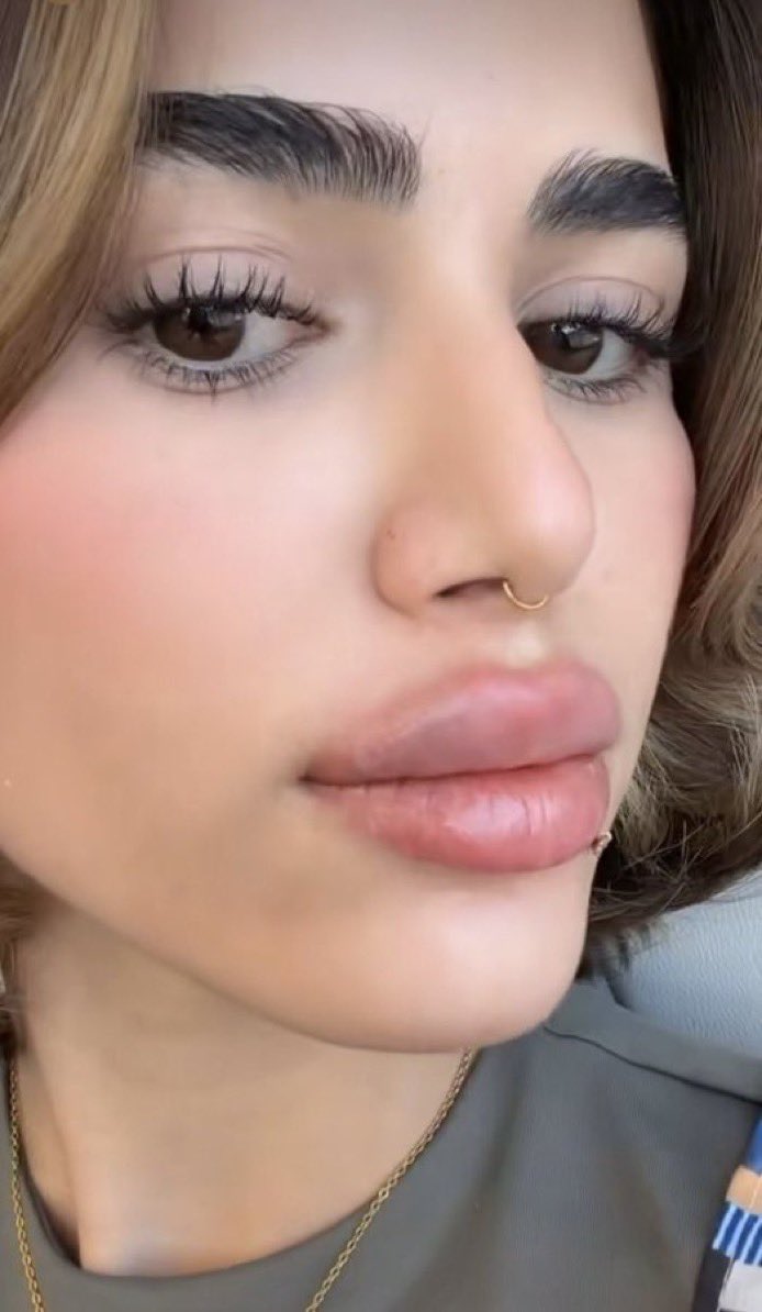 i1lexi's tweet photo. ��فشش ابغى ولد قحبه العن شرفه😭💦🐽 https://t.co/xra8poBxje