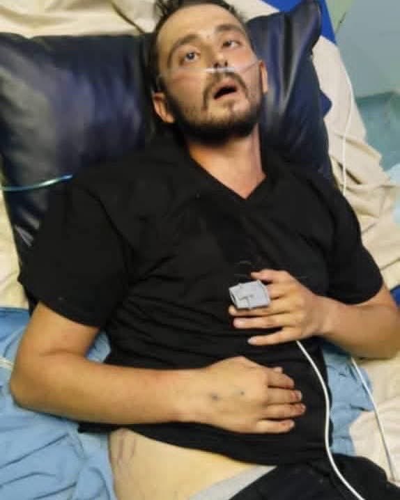 SyJusticeArc's tweet photo. #WesternSyria : Young man tortured after three days of detention in the #Latakia countryside, transferred to intensive care

The young man “Mohammed Ghmeira,” a Civil Defense volunteer belonging to the Sunni sect, suffered severe bleeding in the head and abdomen after being detained by the directorate of al-Haffah district in the Latakia countryside.

Details: A patrol stopped the young man on the pretext of a financial complaint, telling him, “We’ll take you with us to ask a few questions.”

When his family learned of his arrest, they went to the al-Haffah district directorate and told them the young man was ill, asking that he not be beaten. 
They brought him his medication and received promises that he would not be beaten or tortured.

Upon arriving at the police station, he told them: “Guys, don’t hit me, I have a bleeding disorder [hemophilia], don’t hit me”

 but one of the officers cursed him and struck him in the face, after which several terrorists at the station continued beating him on the head and abdomen.

The young man remained detained at the station for three days, was never given his medication, and was in very bad condition after being beaten and tortured. A judge ordered his release, and his family rushed him directly to the hospital.

While in the hospital, the young man was hallucinating and repeating: “I told him don’t hit me, I have a bleeding disorder, I told him…”

The young man has internal bleeding and fell into a coma; he is in a state of clinical death in intensive care. His family reported that his heart stopped before doctors managed to resuscitate him.

It is noted that brutal and inhumane torture continues in most of alJolani prisons and detention centers, with several hundred people (mostly from the Alawite sect and other minorities) killed and tortured inside al-Jolani prisons, which have come to be described as human slaughterhouses. Several shocking testimonies have been recorded of men being raped with objects by guards at Hama Central Prison.

It is noted that the story of the young man “Mohammed Ghmeira” was circulated by media outlets and “journalists” loyal to the #STG because the young man belongs to the Sunni sect, while this same sectarian “journalists” stays silent when the victims of torture and killing belong to minorities,  which points to the moral decline of Syrian media (as well as Saudi and Qatari media) and their departure from the noble goals of journalism.

This news comes after the visit of the UN Secretary-General António Guterres (@antonioguterres) to Syria last month and condemned the torture crimes committed at Sednaya Prison during Assad’s era, yet he did not dare condemn the torture crimes in the alJolani prisons, despite being informed (or presumably informed) of the reports from the UN Human Rights Council’s Commission of Inquiry, which are documented with testimonies about torture and killing operations.