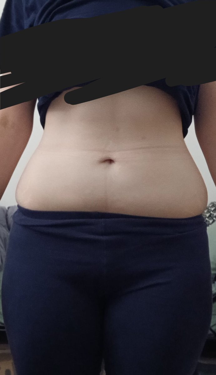 akuneedtwt's tweet photo. is there even a difference ?
bmi 21.9 -> bmi 20.7 https://t.co/9iLeFQEbGW