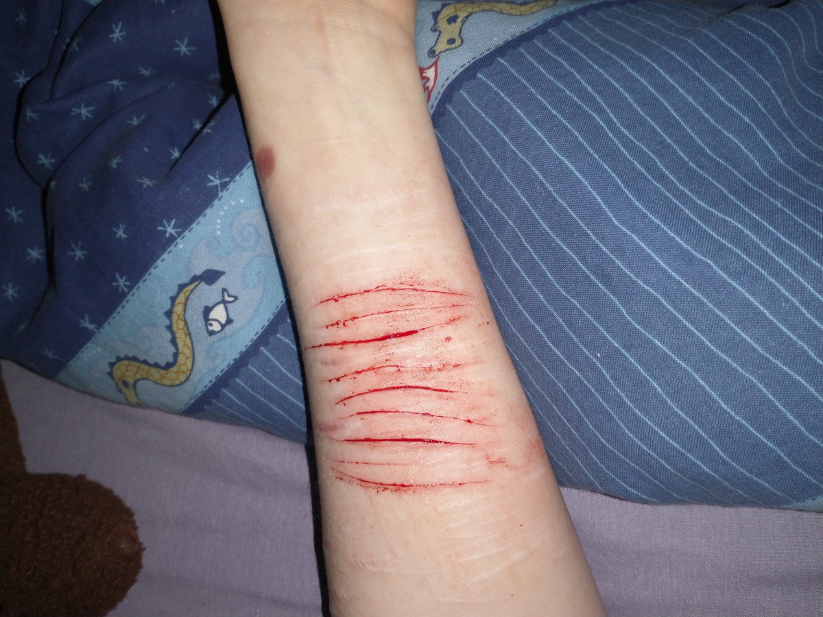 somnibug's tweet photo. i'm such a fucking idiot
(sh picture) https://t.co/jAWjfy5E0s